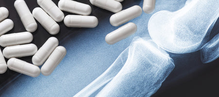 How to Take Glucosamine for Joint Pain Relief — Dosage, Timing, and Best Combinations